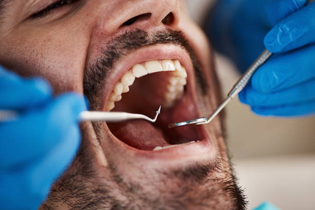 Best Emergency Wisdom Teeth Removal in Brewton, AL